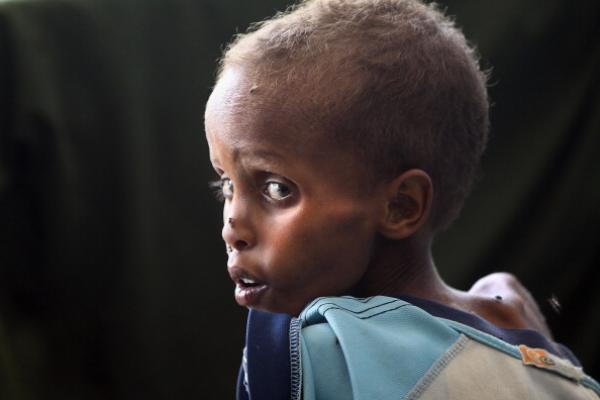 Staving Somali child, 2011. Photo by John Moore/Getty Images