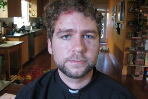 The Rev. John Helmiere, who was beaten by police during a nonviolent protest in 