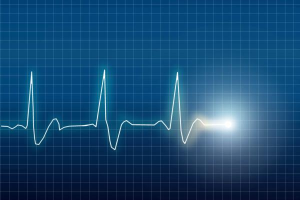 Electrocardiogram, Eskemar / Shutterstock.com