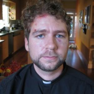 The Rev. John Helmiere, who was beaten by police during a nonviolent protest in December. Via http://bit.ly/vP6XVT. The Rev. John Helmiere, who was beaten by police during a nonviolent protest in