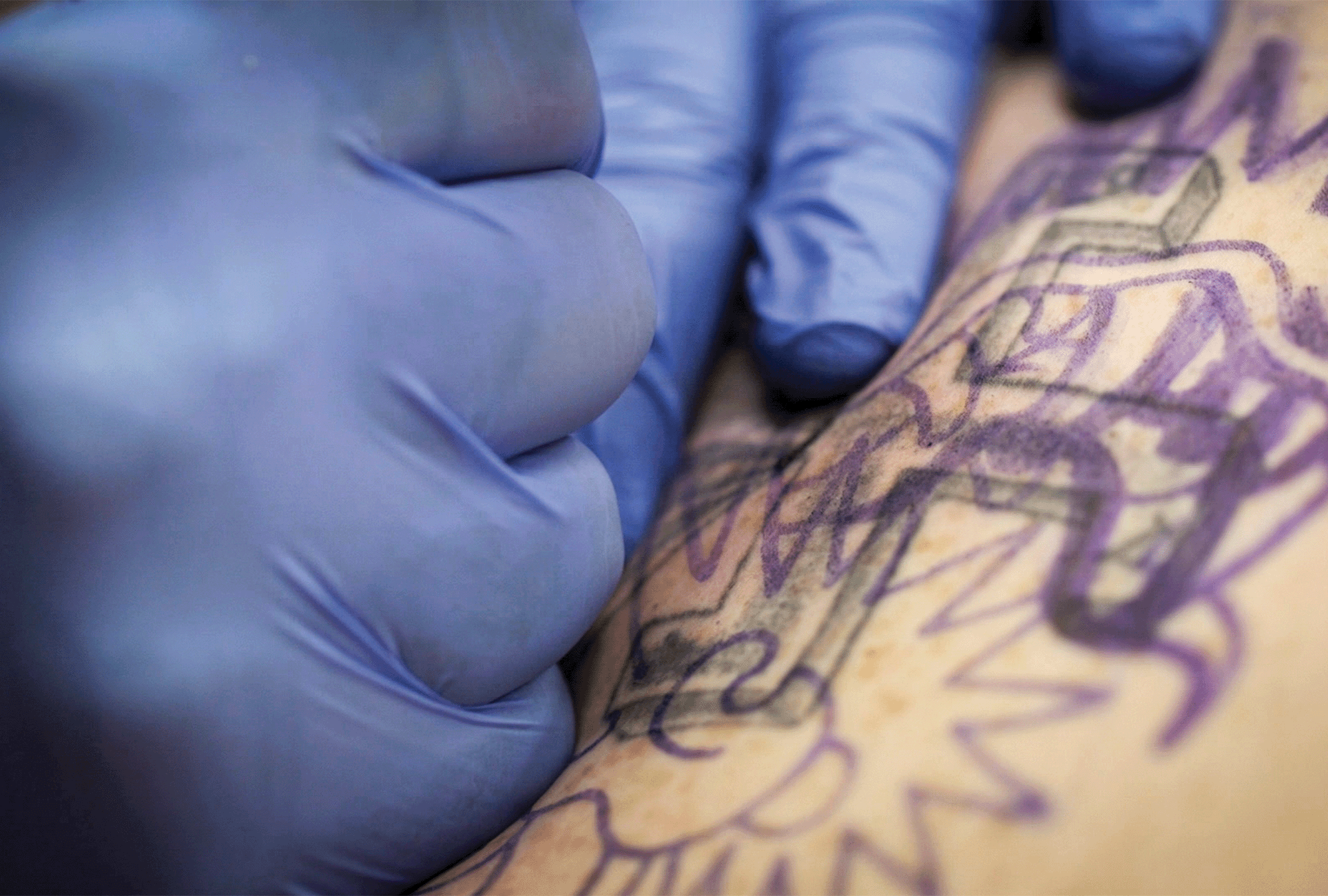 the image shows two hands wearing blue latex gloves doing a tattoo to cover up a Swastika tattoo 