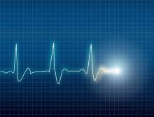 Electrocardiogram, Eskemar / Shutterstock.com Electrocardiogram, Eskemar / Shutterstock.com