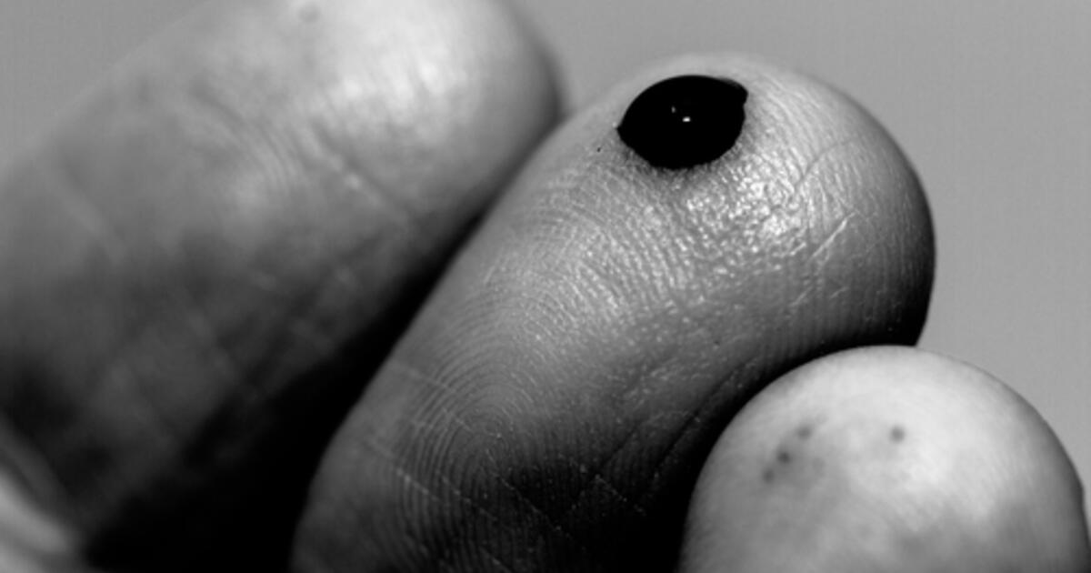 Bleeding Joyfully | Sojourners