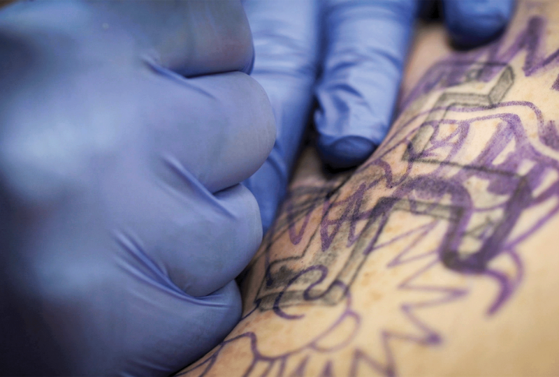 The photo shows two hands wearing blue latex gloves tattooing over a tattoo of a swastika 