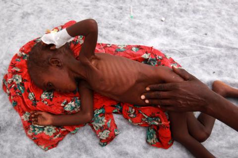 A starving 2-year-old girl is comforted by her mother at a refugee camp in in Mogadishu, Somalia. Photo by John Moore/Getty. Photo by John Moore/Getty Images