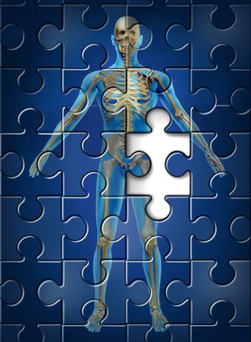 Puzzle of human skeleton with missing portion of hip. Photo courtesy Lightspring/shutterstock.com Puzzle of human skeleton with missing portion of hip. Photo courtesy Lightspring