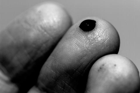 Pricked finger, Chris G. Walker / Shutterstock.com Pricked finger, Chris G. Walker / Shutterstock.com