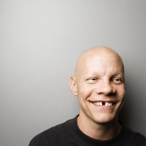Portrait of mid-adult male with missing tooth. iofoto / Shutterstock iofoto / Shutterstock