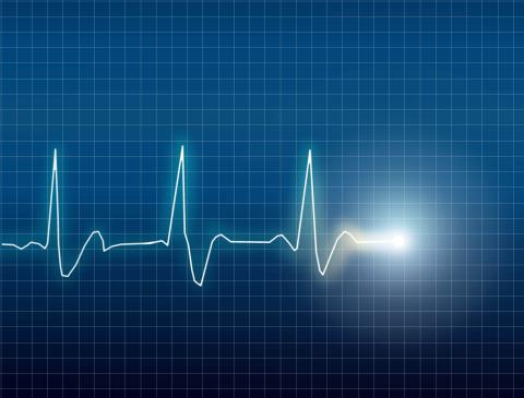 Electrocardiogram, Eskemar / Shutterstock.com Electrocardiogram, Eskemar / Shutterstock.com