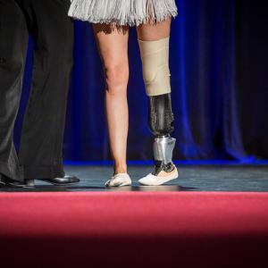 Dancers Christian Lightner and Adrianne Haslet-Davis at TED2014 - The Next Chapter, via TED Conference / Flickr.com via TED Conference / Flickr.com