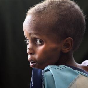 Staving Somali child, 2011. Photo by John Moore/Getty Images