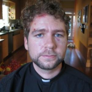 The Rev. John Helmiere, who was beaten by police during a nonviolent protest in 