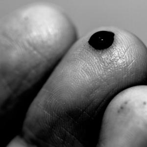 Pricked finger, Chris G. Walker / Shutterstock.com