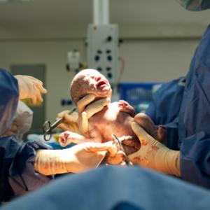 Baby being delivered by cesarean, Martin Valigursky / Shutterstock.com